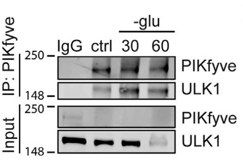Endogenous PIKfyve immunoprecipitated from HEK 293T cells.jpg